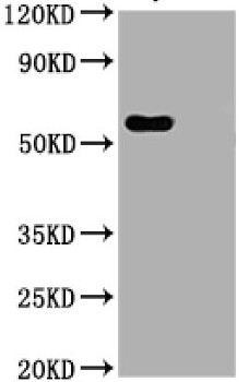 Western blot using Novel Coronovirus Nucleoprotein (N)